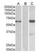BAI1 Associated Protein 2 antibody, orb18325, Biorbyt, Western Blot image 
