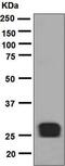 Interleukin 12A antibody, ab133751, Abcam, Western Blot image 