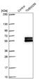 Transmembrane Protein 259 antibody, NBP1-90088, Novus Biologicals, Western Blot image 