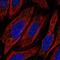 Transmembrane Protein Adipocyte Associated 1 antibody, NBP2-13470, Novus Biologicals, Immunofluorescence image 