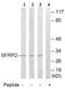 Secreted Frizzled Related Protein 2 antibody, ab92667, Abcam, Western Blot image 