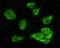 Glycogen Synthase Kinase 3 Alpha antibody, 32-163, ProSci, Western Blot image 