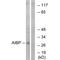 NAD(P)HX Epimerase antibody, A10537, Boster Biological Technology, Western Blot image 