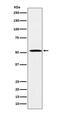 Fatty Acid Desaturase 1 antibody, M02535, Boster Biological Technology, Western Blot image 