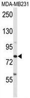 ADAM Metallopeptidase Domain 9 antibody, GTX81448, GeneTex, Western Blot image 