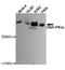 Protein Kinase, DNA-Activated, Catalytic Subunit antibody, GTX49138, GeneTex, Western Blot image 