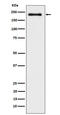 WRN RecQ Like Helicase antibody, M00873, Boster Biological Technology, Western Blot image 