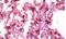 Pulmonary surfactant-associated protein A antibody, NBP2-12928, Novus Biologicals, Immunohistochemistry paraffin image 