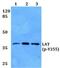Linker For Activation Of T Cells antibody, PA5-37349, Invitrogen Antibodies, Western Blot image 