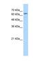 GUSB antibody, NBP1-69355, Novus Biologicals, Western Blot image 