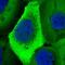 Ubiquitin A-52 Residue Ribosomal Protein Fusion Product 1 antibody, NBP2-55293, Novus Biologicals, Immunofluorescence image 