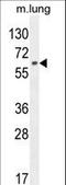 Nuclear Factor, Erythroid 2 Like 1 antibody, LS-C164844, Lifespan Biosciences, Western Blot image 