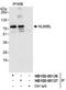 NUMB Like Endocytic Adaptor Protein antibody, NB100-88136, Novus Biologicals, Western Blot image 