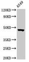 Nucleolar Protein 4 Like antibody, CSB-PA856989LA01HU, Cusabio, Western Blot image 