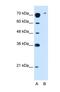 Solute Carrier Family 7 Member 14 antibody, NBP1-59892, Novus Biologicals, Western Blot image 