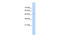 Family With Sequence Similarity 174 Member B antibody, 29-797, ProSci, Western Blot image 