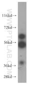 USP14 antibody, 14517-1-AP, Proteintech Group, Western Blot image 