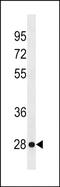 Killer Cell Lectin Like Receptor F2 antibody, PA5-49096, Invitrogen Antibodies, Western Blot image 