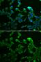 Complement C1r antibody, GTX33049, GeneTex, Immunocytochemistry image 