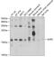 Anterior Gradient 2, Protein Disulphide Isomerase Family Member antibody, GTX32995, GeneTex, Western Blot image 