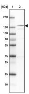 Neuronal Cell Adhesion Molecule antibody, PA5-52956, Invitrogen Antibodies, Western Blot image 