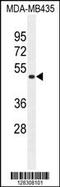 Transmembrane Anterior Posterior Transformation 1 antibody, MBS9214426, MyBioSource, Western Blot image 