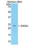 Glypican 1 antibody, LS-C298962, Lifespan Biosciences, Western Blot image 