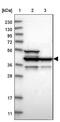 DNA fragmentation factor subunit alpha antibody, NBP1-85247, Novus Biologicals, Western Blot image 