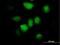 Zinc Finger Protein 74 antibody, H00007625-B01P, Novus Biologicals, Immunocytochemistry image 