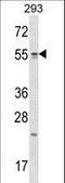 Tetratricopeptide Repeat Domain 23 antibody, LS-C160293, Lifespan Biosciences, Western Blot image 