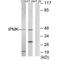 Inositol Polyphosphate Multikinase antibody, A06955, Boster Biological Technology, Western Blot image 