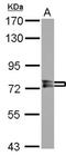 Protein Phosphatase With EF-Hand Domain 1 antibody, NBP2-19897, Novus Biologicals, Western Blot image 