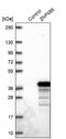 Zinc Finger Protein 688 antibody, NBP2-30749, Novus Biologicals, Western Blot image 
