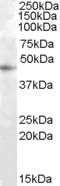 Ras association domain-containing protein 6 antibody, EB08394, Everest Biotech, Western Blot image 