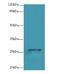 Transmembrane Protein 217 antibody, MBS1492009, MyBioSource, Western Blot image 