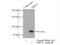 MRE11 Homolog, Double Strand Break Repair Nuclease antibody, 10744-1-AP, Proteintech Group, Immunoprecipitation image 