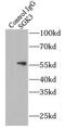 Serum/Glucocorticoid Regulated Kinase Family Member 3 antibody, FNab07808, FineTest, Immunoprecipitation image 