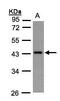 G Protein Subunit Alpha Z antibody, GTX105832, GeneTex, Western Blot image 