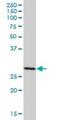 SCO Cytochrome C Oxidase Assembly Protein 1 antibody, H00006341-B01P, Novus Biologicals, Western Blot image 