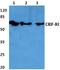 Corticotropin Releasing Hormone Receptor 1 antibody, A01298, Boster Biological Technology, Western Blot image 