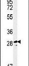Tescalcin antibody, PA5-25060, Invitrogen Antibodies, Western Blot image 