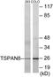 Tetraspanin 8 antibody, EKC1687, Boster Biological Technology, Western Blot image 