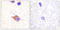 Phospholipase C Gamma 2 antibody, LS-C199476, Lifespan Biosciences, Immunohistochemistry paraffin image 