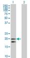 Carcinoembryonic Antigen Related Cell Adhesion Molecule 21 antibody, H00090273-D01P, Novus Biologicals, Western Blot image 