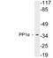 Protein Phosphatase 1 Catalytic Subunit Alpha antibody, LS-C199974, Lifespan Biosciences, Western Blot image 