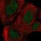 Retinoic Acid Induced 14 antibody, NBP1-94076, Novus Biologicals, Immunofluorescence image 
