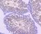 Dynein Axonemal Intermediate Chain 1 antibody, NBP2-66804, Novus Biologicals, Immunohistochemistry paraffin image 