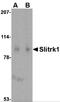 SLIT And NTRK Like Family Member 1 antibody, 4453, ProSci, Western Blot image 