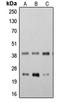 Transmembrane Protein 173 antibody, LS-C354234, Lifespan Biosciences, Western Blot image 