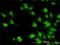 Interleukin 1 Receptor Associated Kinase 1 antibody, H00003654-M02, Novus Biologicals, Immunofluorescence image 
